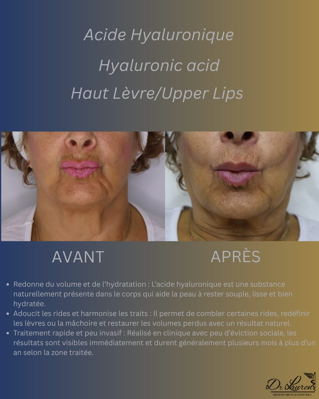 Autres régions — 2
