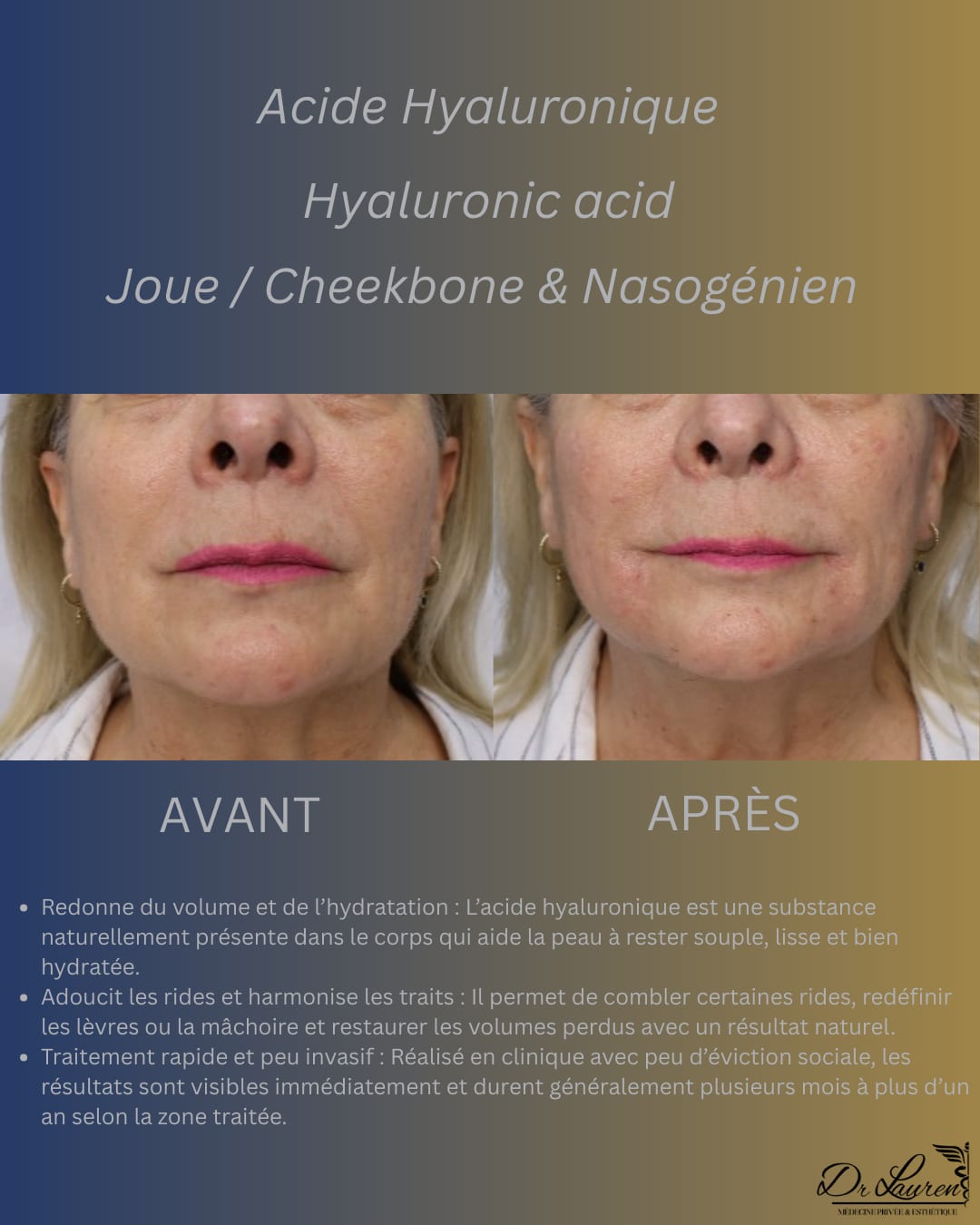Autres régions — 3